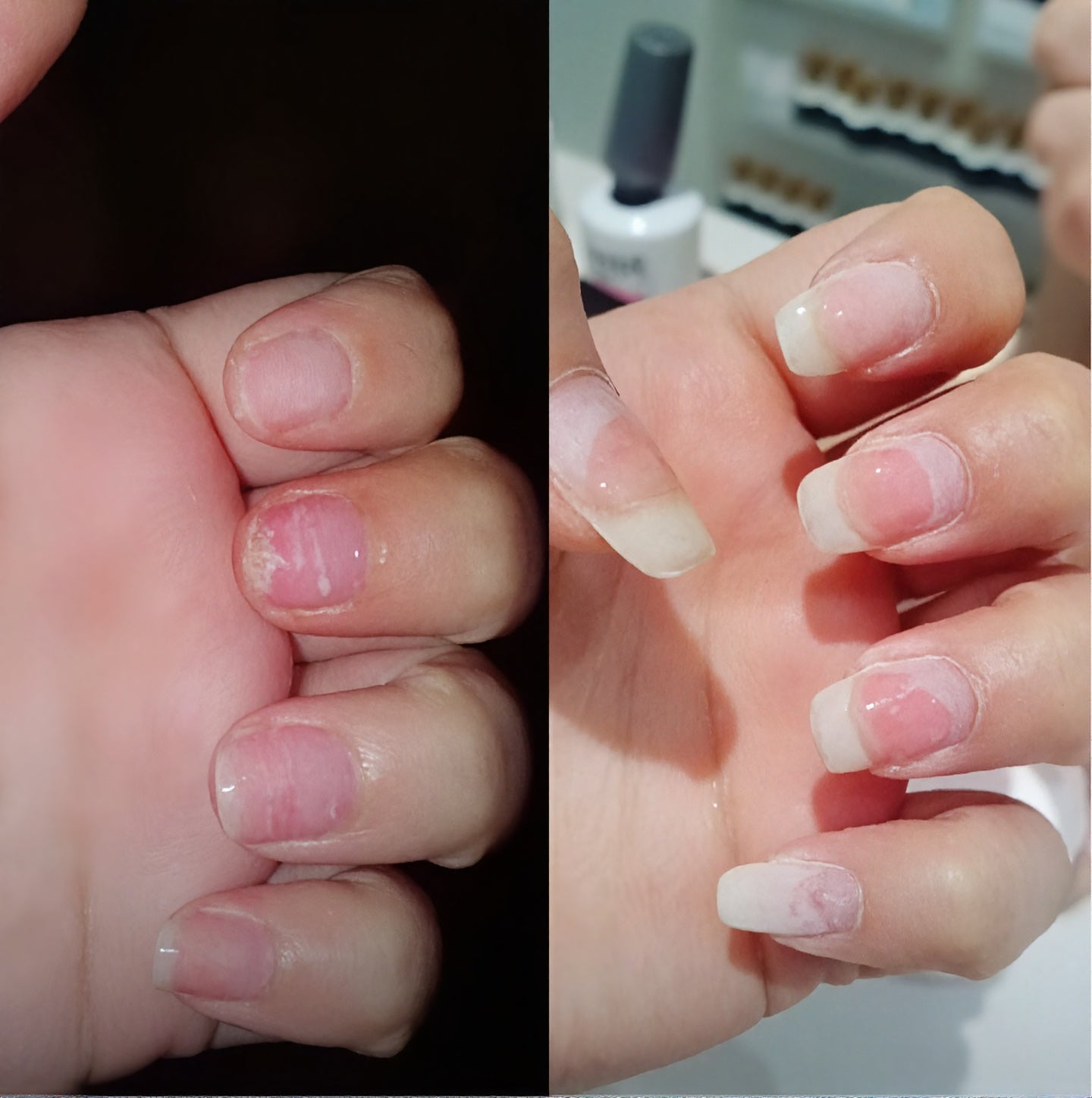 Lumina Nail Growth Serum Oil Before and After