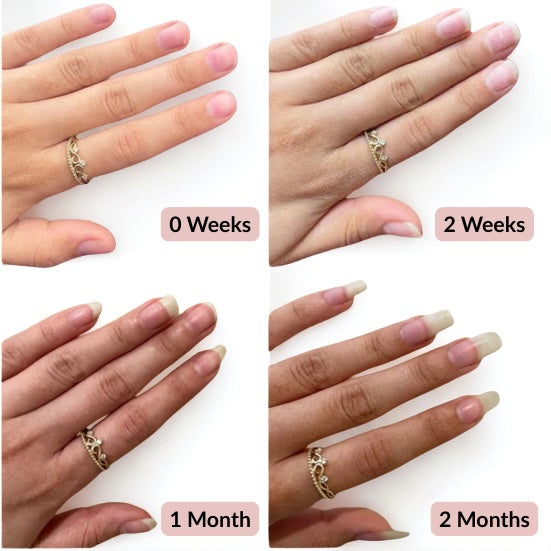 Nail Growth Serum Results