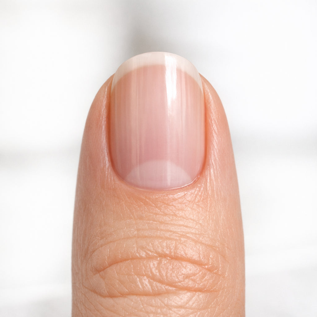 Healthy grown natural nail after Lumina